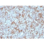 Immunohistochemistry - Anti-Calpastatin Antibody [CAST/1550] (A250411) - Antibodies.com