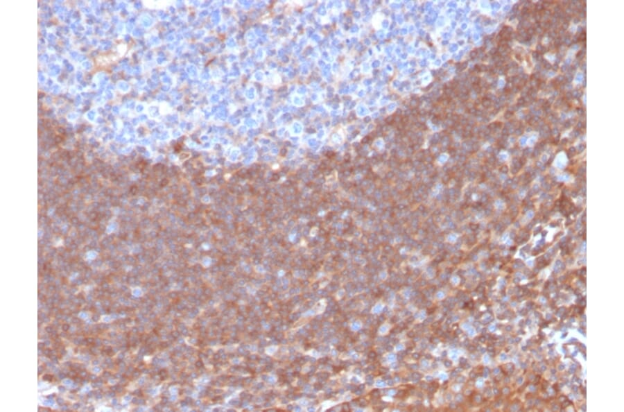 Immunohistochemistry - Anti-Calpastatin Antibody [CAST/1550] (A250412) - Antibodies.com