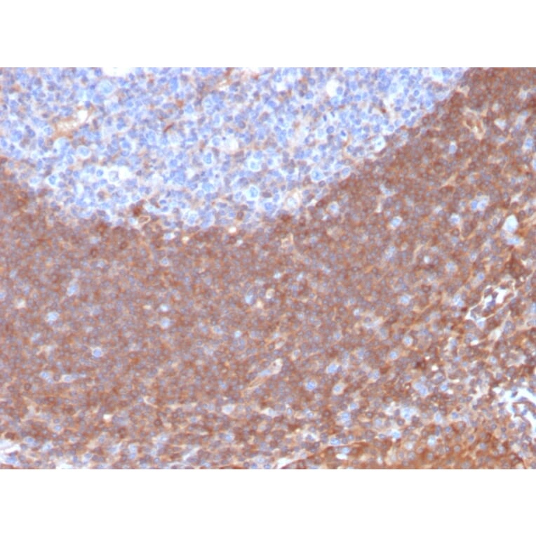 Immunohistochemistry - Anti-Calpastatin Antibody [CAST/1550] (A250412) - Antibodies.com