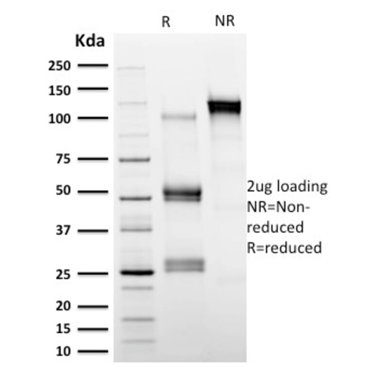 SDS-PAGE - Anti-Calpastatin Antibody [CAST/1550] (A250412) - Antibodies.com