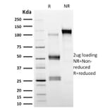 SDS-PAGE - Anti-Calpastatin Antibody [CAST/1550] (A250412) - Antibodies.com