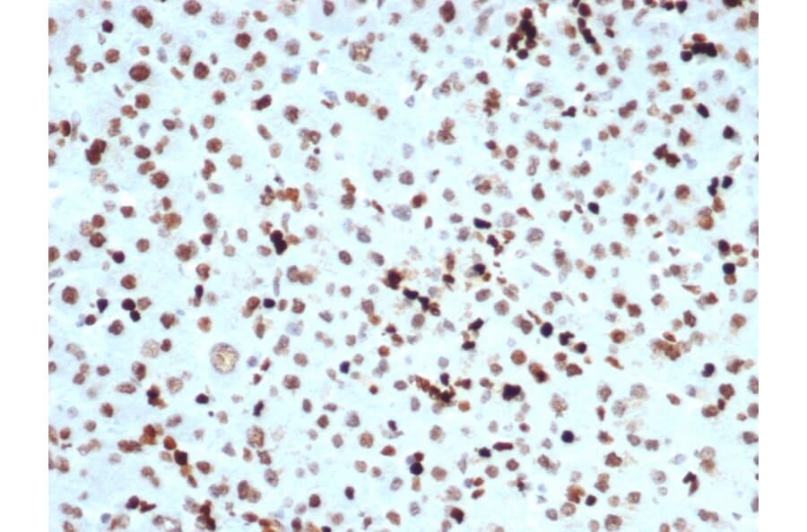 Immunohistochemistry - Anti-Histone H3 (phospho Ser10) Antibody [PHH3/471R] (A250413) - Antibodies.com