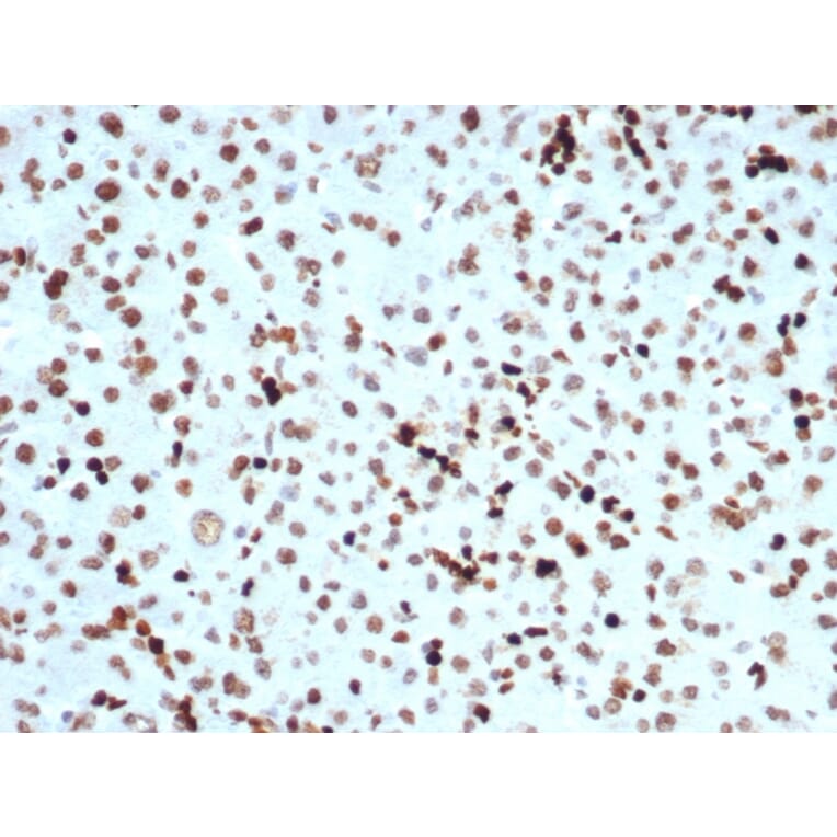 Immunohistochemistry - Anti-Histone H3 (phospho Ser10) Antibody [PHH3/471R] (A250413) - Antibodies.com