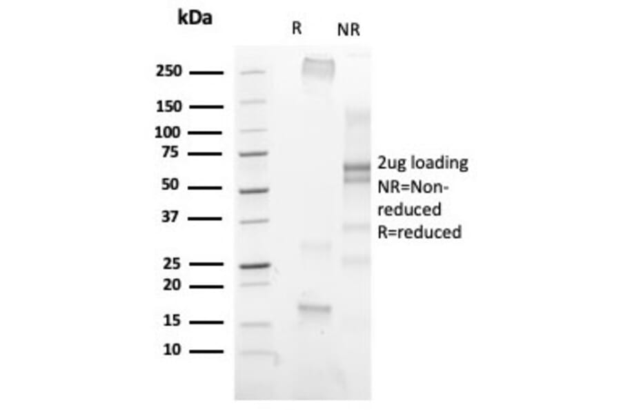 SDS-PAGE - Anti-Histone H3 (phospho Ser10) Antibody [PHH3/471R] (A250413) - Antibodies.com