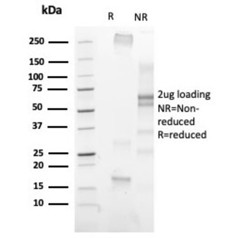 SDS-PAGE - Anti-Histone H3 (phospho Ser10) Antibody [PHH3/471R] (A250413) - Antibodies.com