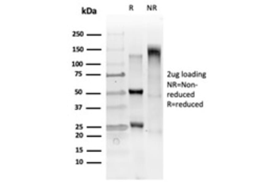 SDS-PAGE - Anti-GTF2IRD2 Antibody [PCRP-GTF2IRD2-1B4] (A250415) - Antibodies.com