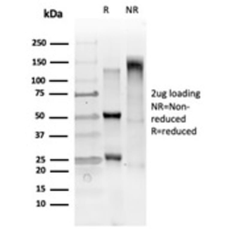 SDS-PAGE - Anti-GTF2IRD2 Antibody [PCRP-GTF2IRD2-1B4] (A250415) - Antibodies.com