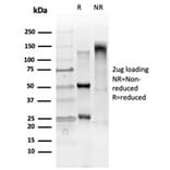 SDS-PAGE - Anti-GTF2IRD2 Antibody [PCRP-GTF2IRD2-1B4] (A250415) - Antibodies.com