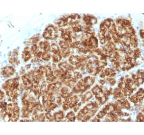 Immunohistochemistry - Anti-MAML2 Antibody [MAML2/1302] (A250416) - Antibodies.com