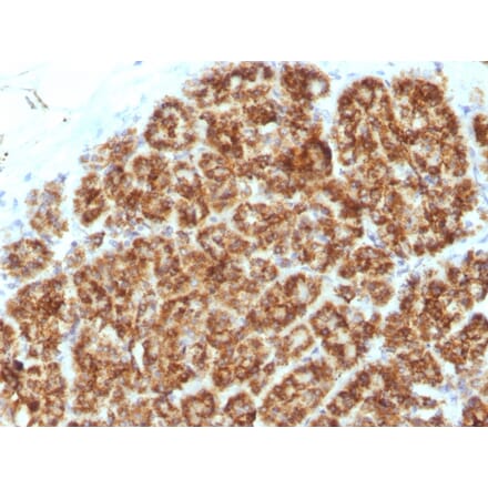 Immunohistochemistry - Anti-MAML2 Antibody [MAML2/1302] (A250416) - Antibodies.com