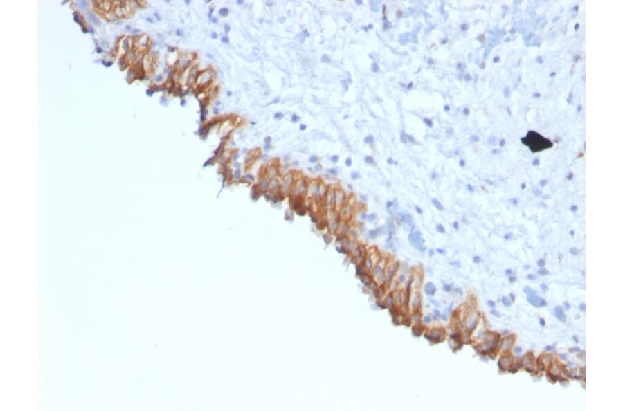 Immunohistochemistry - Anti-MAML2 Antibody [MAML2/1302] (A250415) - Antibodies.com