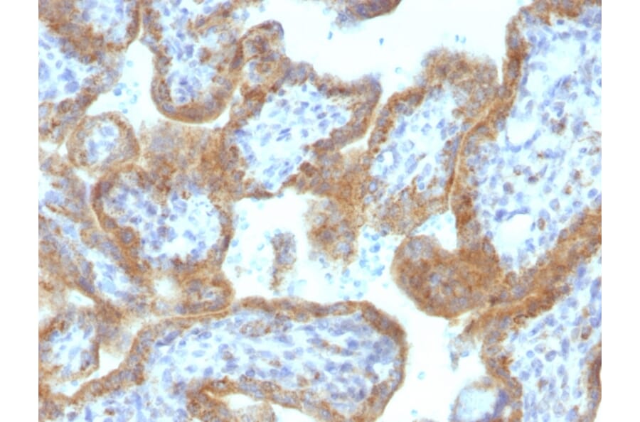 Immunohistochemistry - Anti-MAML2 Antibody [MAML2/1302] (A250416) - Antibodies.com