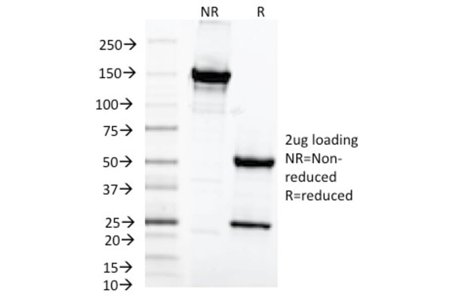 SDS-PAGE - Anti-MAML2 Antibody [MAML2/1302] (A250416) - Antibodies.com