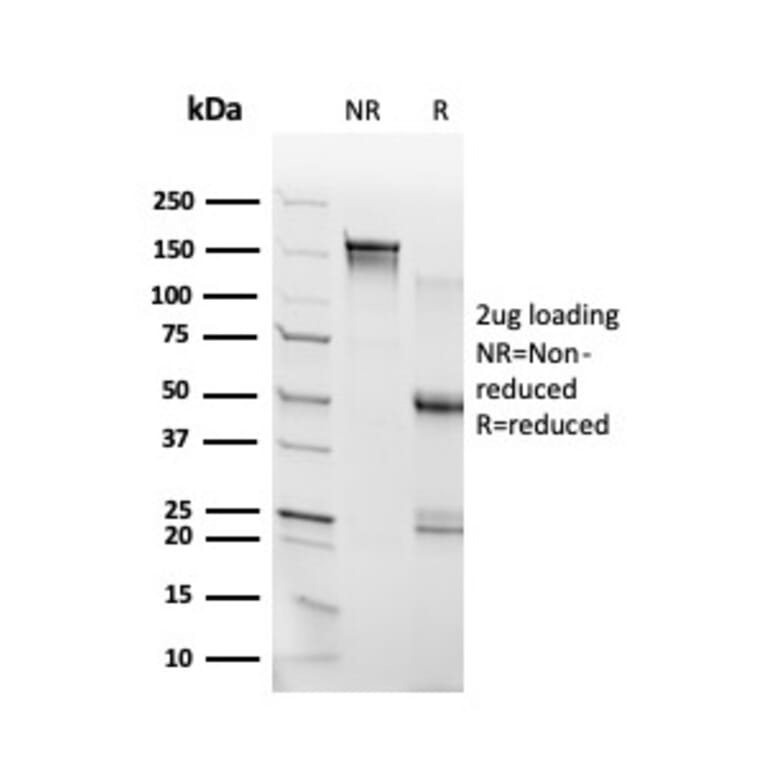 SDS-PAGE - Anti-RHOXF2 Antibody [PCRP-RHOXF2-1D7] (A250417) - Antibodies.com