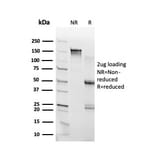 SDS-PAGE - Anti-RHOXF2 Antibody [PCRP-RHOXF2-1D7] (A250417) - Antibodies.com