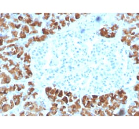 Immunohistochemistry - Anti-INSM2 Antibody [INSM2/4291] (A250418) - Antibodies.com