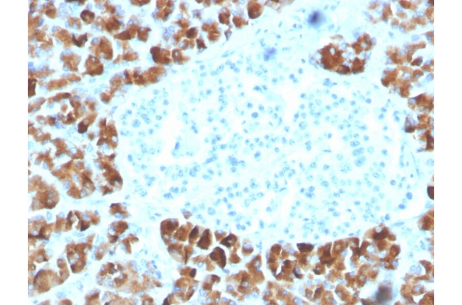 Immunohistochemistry - Anti-INSM2 Antibody [INSM2/4291] (A250418) - Antibodies.com