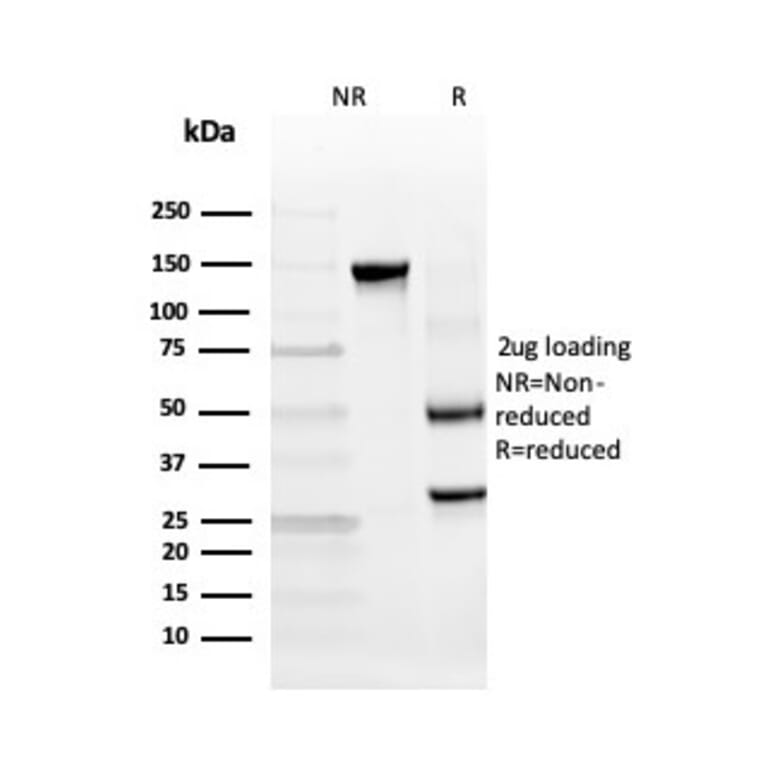SDS-PAGE - Anti-INSM2 Antibody [INSM2/4291] (A250418) - Antibodies.com