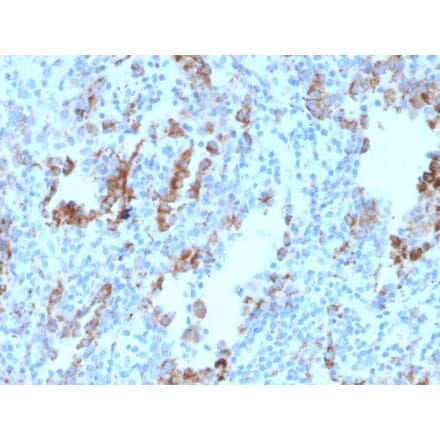Immunohistochemistry - Anti-TIM3 Antibody [TIM3/4030] (A250419) - Antibodies.com