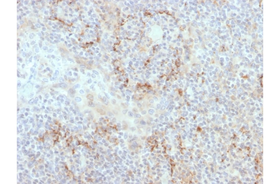 Immunohistochemistry - Anti-TIM3 Antibody [TIM3/4030] (A250419) - Antibodies.com