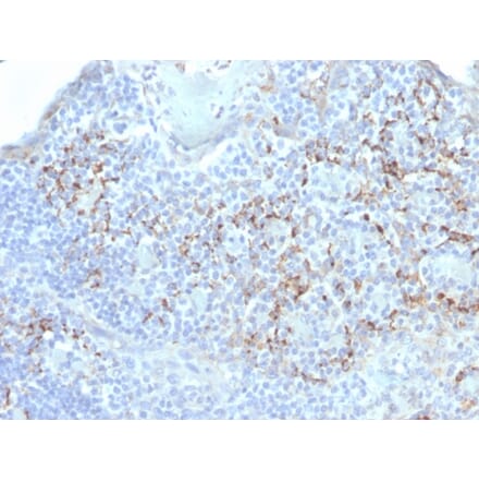 Immunohistochemistry - Anti-TIM3 Antibody [TIM3/4031] (A250420) - Antibodies.com