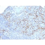 Immunohistochemistry - Anti-TIM3 Antibody [TIM3/4031] (A250420) - Antibodies.com