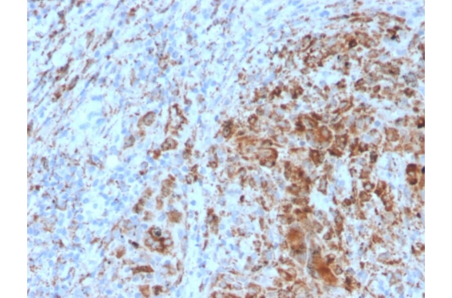 Immunohistochemistry - Anti-TIM3 Antibody [TIM3/4031] (A250420) - Antibodies.com