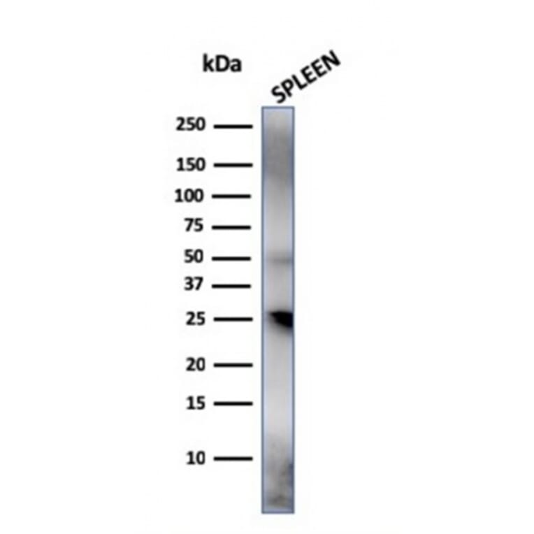 Western Blot - Anti-TIM3 Antibody [TIM3/4031] (A250420) - Antibodies.com