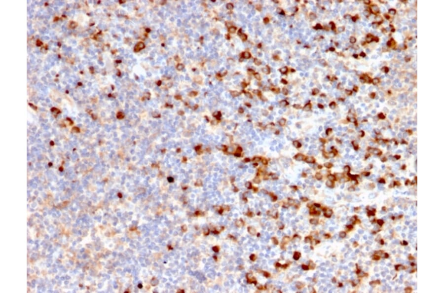 Immunohistochemistry - Anti-TIM3 Antibody [TIM3/2399] (A250421) - Antibodies.com