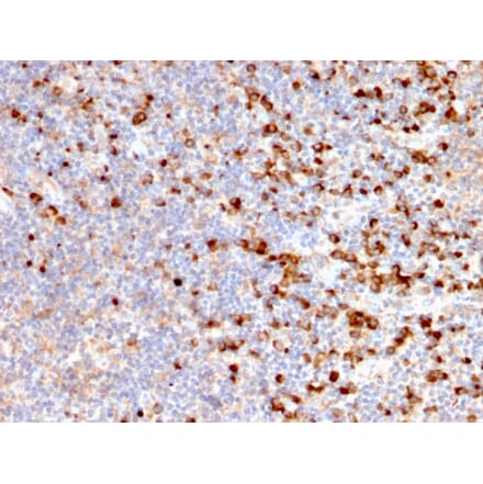 Immunohistochemistry - Anti-TIM3 Antibody [TIM3/2399] (A250421) - Antibodies.com