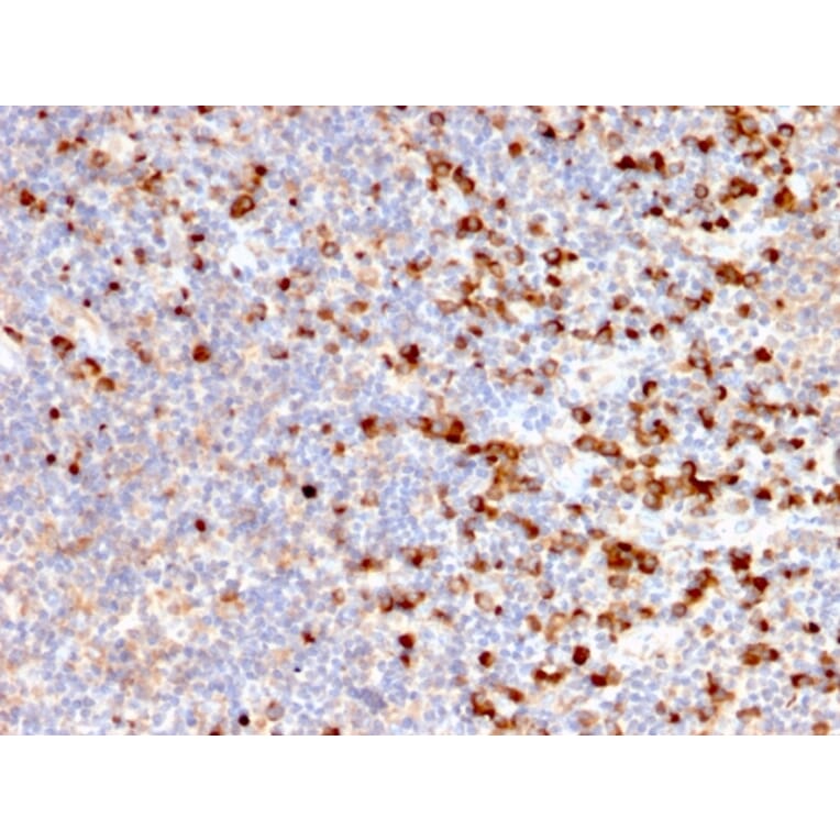 Immunohistochemistry - Anti-TIM3 Antibody [TIM3/2399] (A250421) - Antibodies.com
