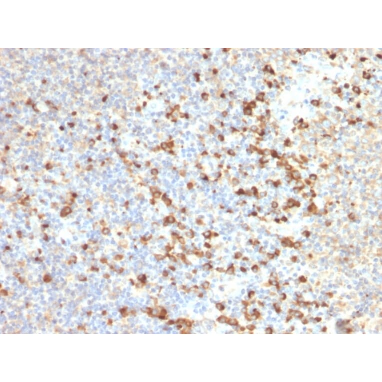 Immunohistochemistry - Anti-TIM3 Antibody [TIM3/2399] (A250420) - Antibodies.com