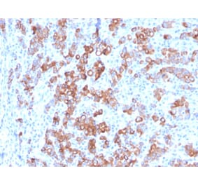 Immunohistochemistry - Anti-TIM3 Antibody [TIM3/3113] (A250422) - Antibodies.com