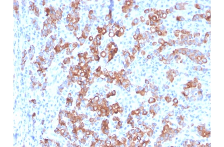 Immunohistochemistry - Anti-TIM3 Antibody [TIM3/3113] (A250422) - Antibodies.com