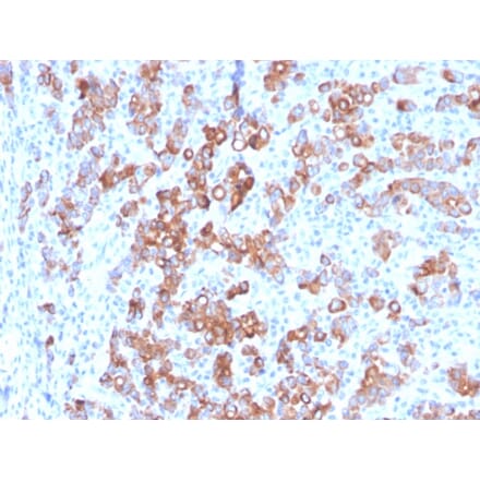 Immunohistochemistry - Anti-TIM3 Antibody [TIM3/3113] (A250422) - Antibodies.com