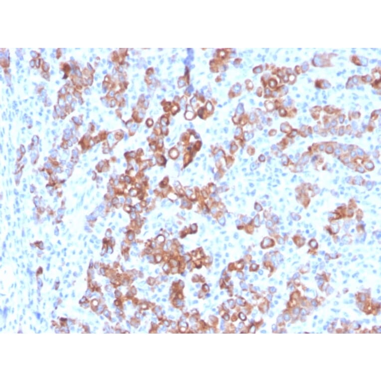 Immunohistochemistry - Anti-TIM3 Antibody [TIM3/3113] (A250422) - Antibodies.com