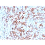 Immunohistochemistry - Anti-TIM3 Antibody [TIM3/3113] (A250422) - Antibodies.com