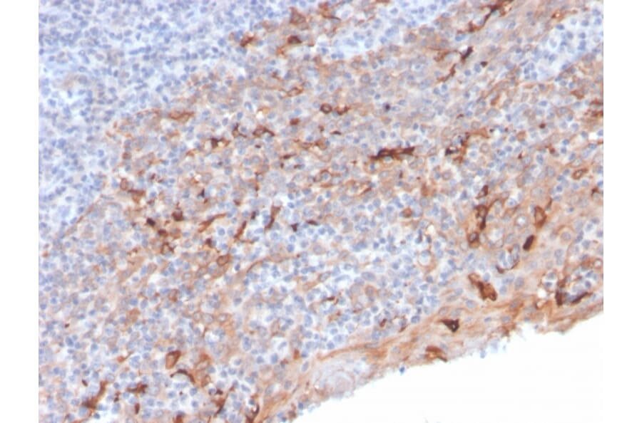 Immunohistochemistry - Anti-TIM3 Antibody [TIM3/3113] (A250422) - Antibodies.com