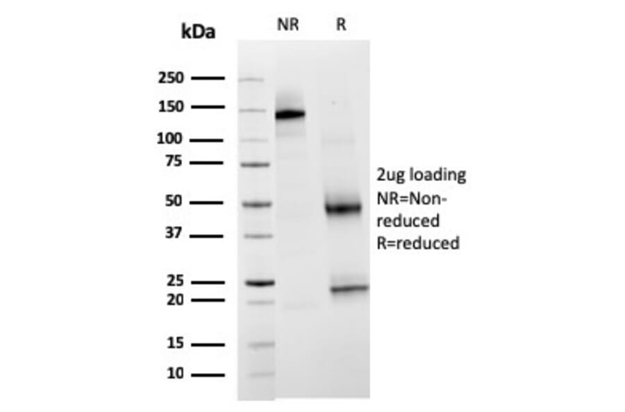 SDS-PAGE - Anti-TIM3 Antibody [TIM3/3113] (A250422) - Antibodies.com