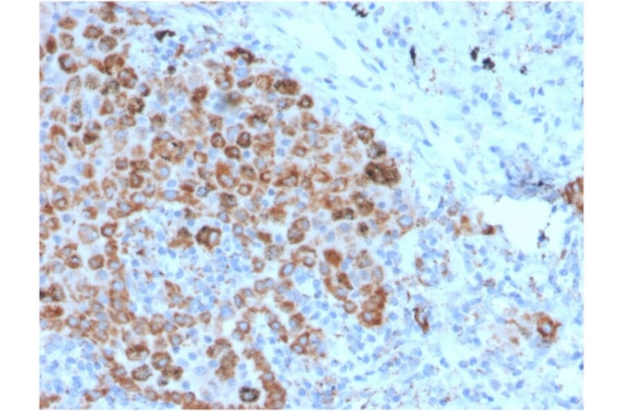 Immunohistochemistry - Anti-TIM3 Antibody [TIM3/4025] (A250423) - Antibodies.com