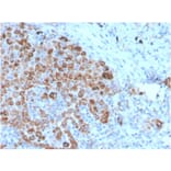 Immunohistochemistry - Anti-TIM3 Antibody [TIM3/4025] (A250423) - Antibodies.com