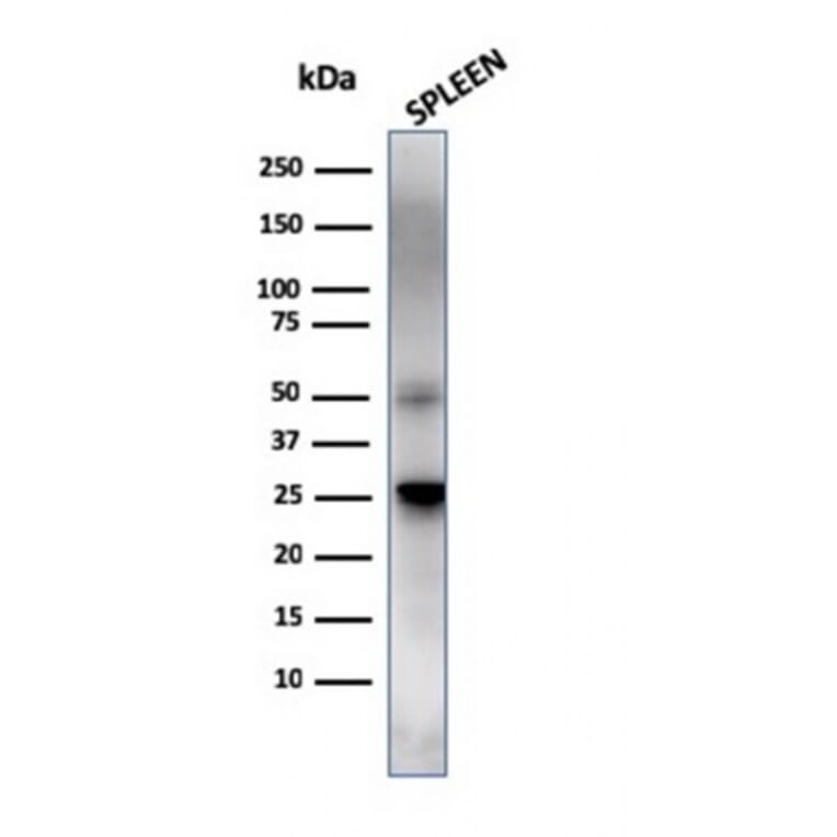 Western Blot - Anti-TIM3 Antibody [TIM3/4025] (A250423) - Antibodies.com