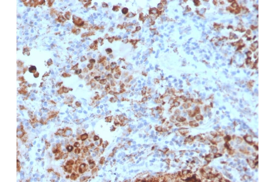 Immunohistochemistry - Anti-TIM3 Antibody [TIM3/4028] (A250424) - Antibodies.com