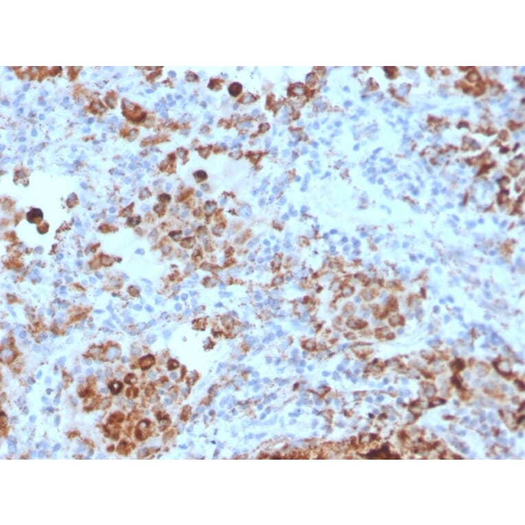 Immunohistochemistry - Anti-TIM3 Antibody [TIM3/4028] (A250424) - Antibodies.com