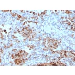 Immunohistochemistry - Anti-TIM3 Antibody [TIM3/4028] (A250424) - Antibodies.com