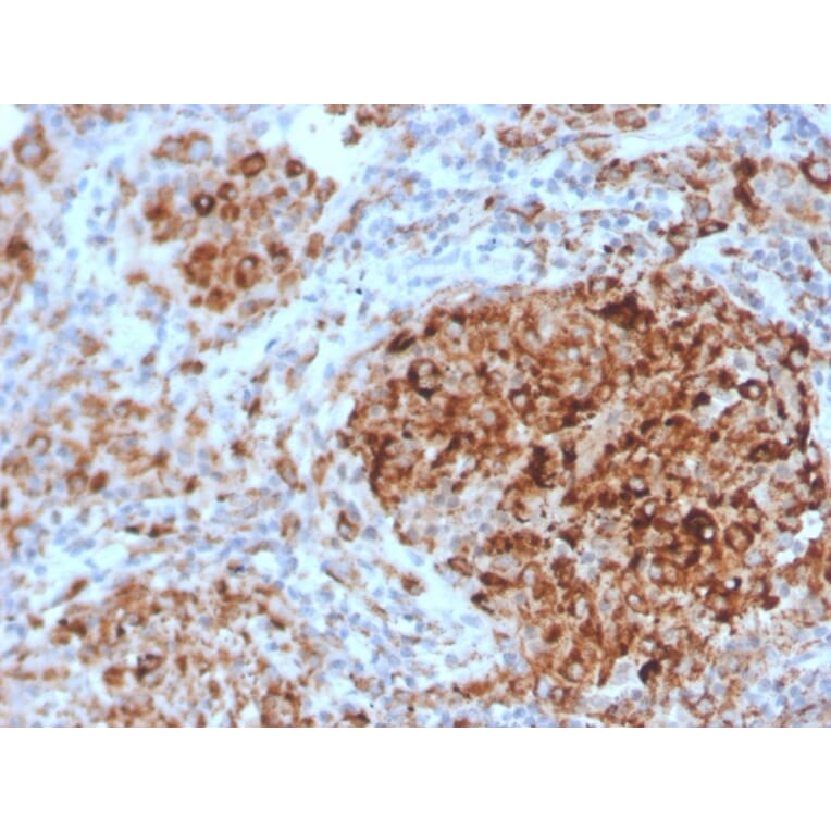 Immunohistochemistry - Anti-TIM3 Antibody [TIM3/4028] (A250424) - Antibodies.com
