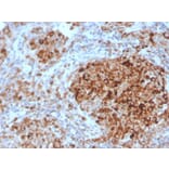 Immunohistochemistry - Anti-TIM3 Antibody [TIM3/4028] (A250424) - Antibodies.com