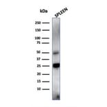 Western Blot - Anti-TIM3 Antibody [TIM3/4028] (A250424) - Antibodies.com