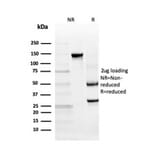SDS-PAGE - Anti-TIM3 Antibody [TIM3/4028] (A250424) - Antibodies.com