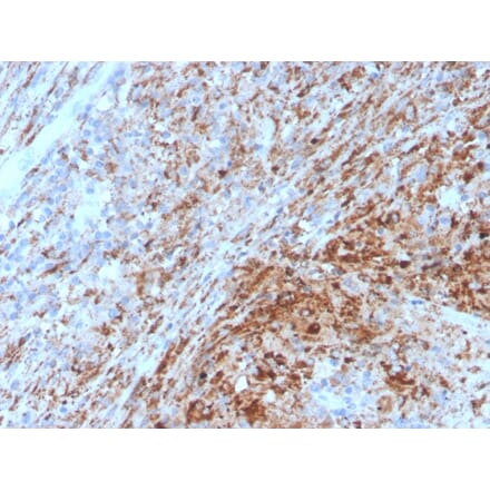 Immunohistochemistry - Anti-TIM3 Antibody [TIM3/4029] (A250425) - Antibodies.com
